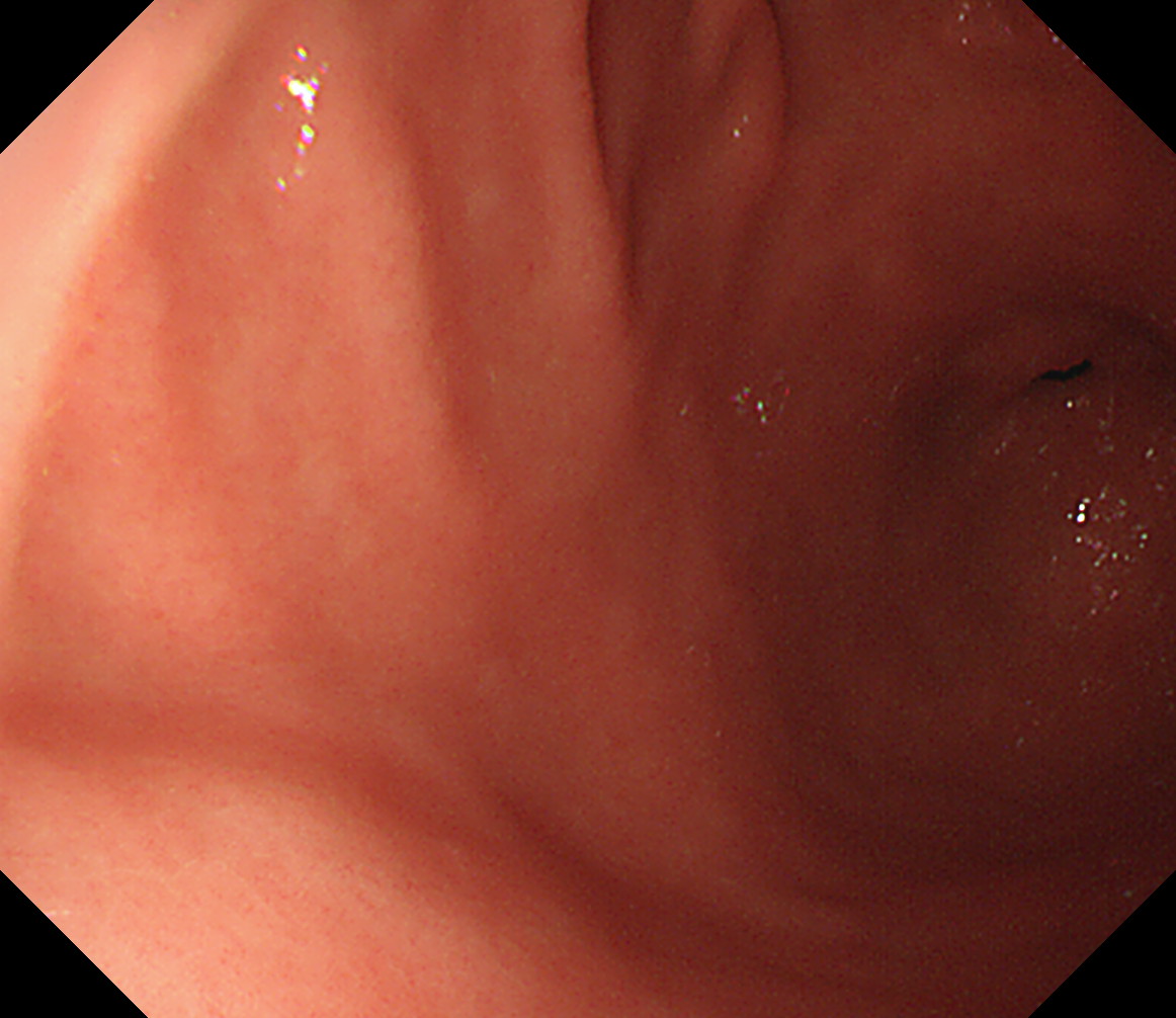 �H�啔�O��